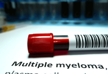 Mieloma