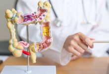 El pasado 27 de agosto de llevó a cabo el seminario web “Cáncer colorrectal: tamizaje, diagnóstico y tratamiento”.